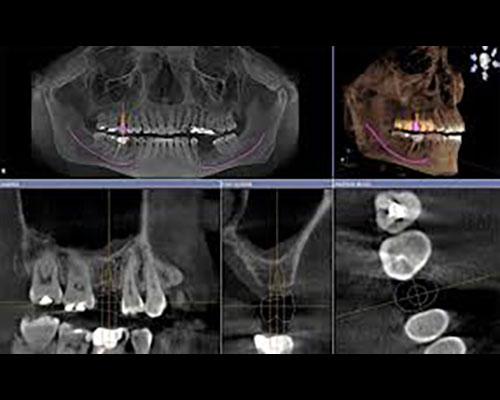 9-foto-rx-cone-beam